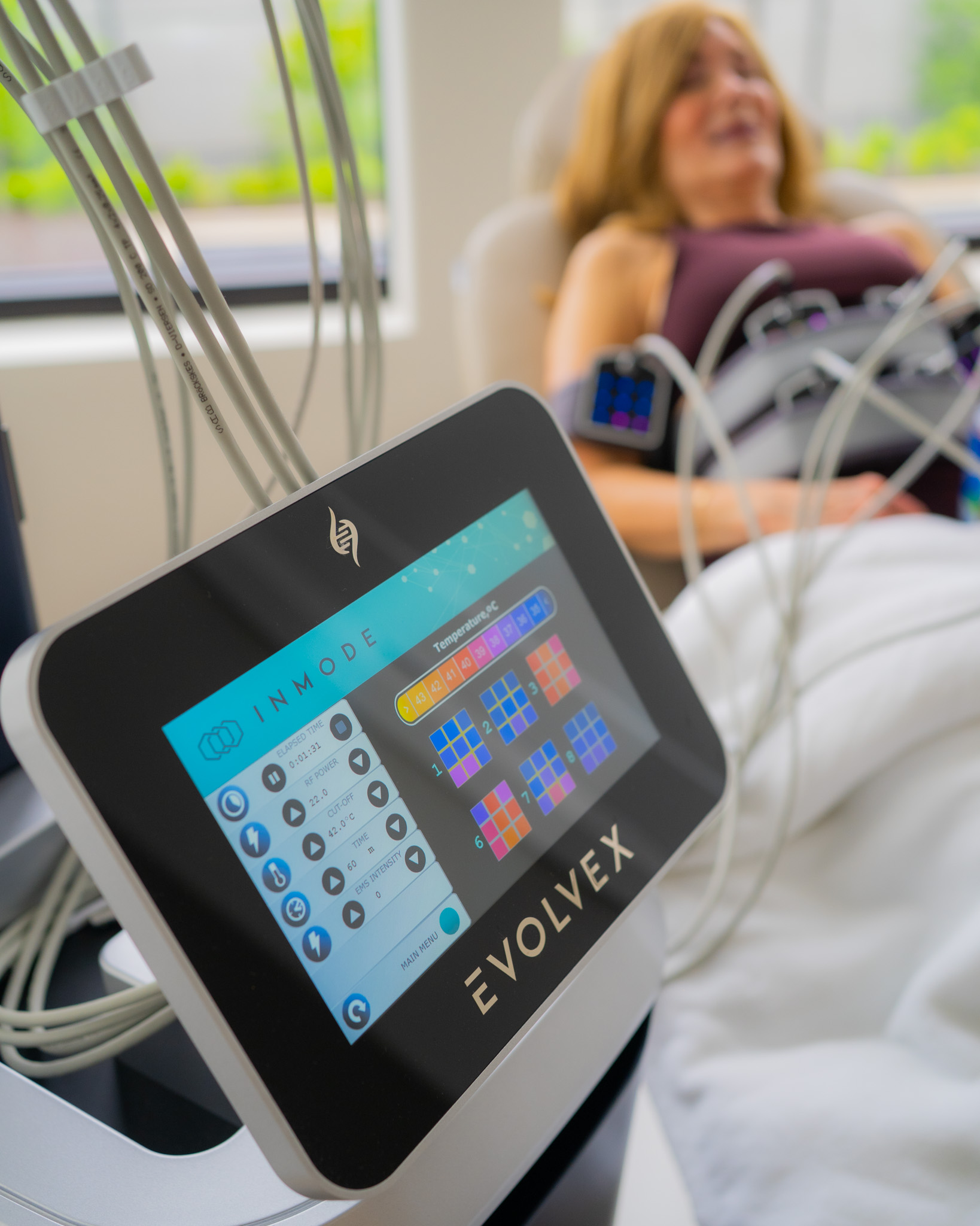 The EvolveX console showing applicator temperatures during a Transform session, with the patient reclined behind it