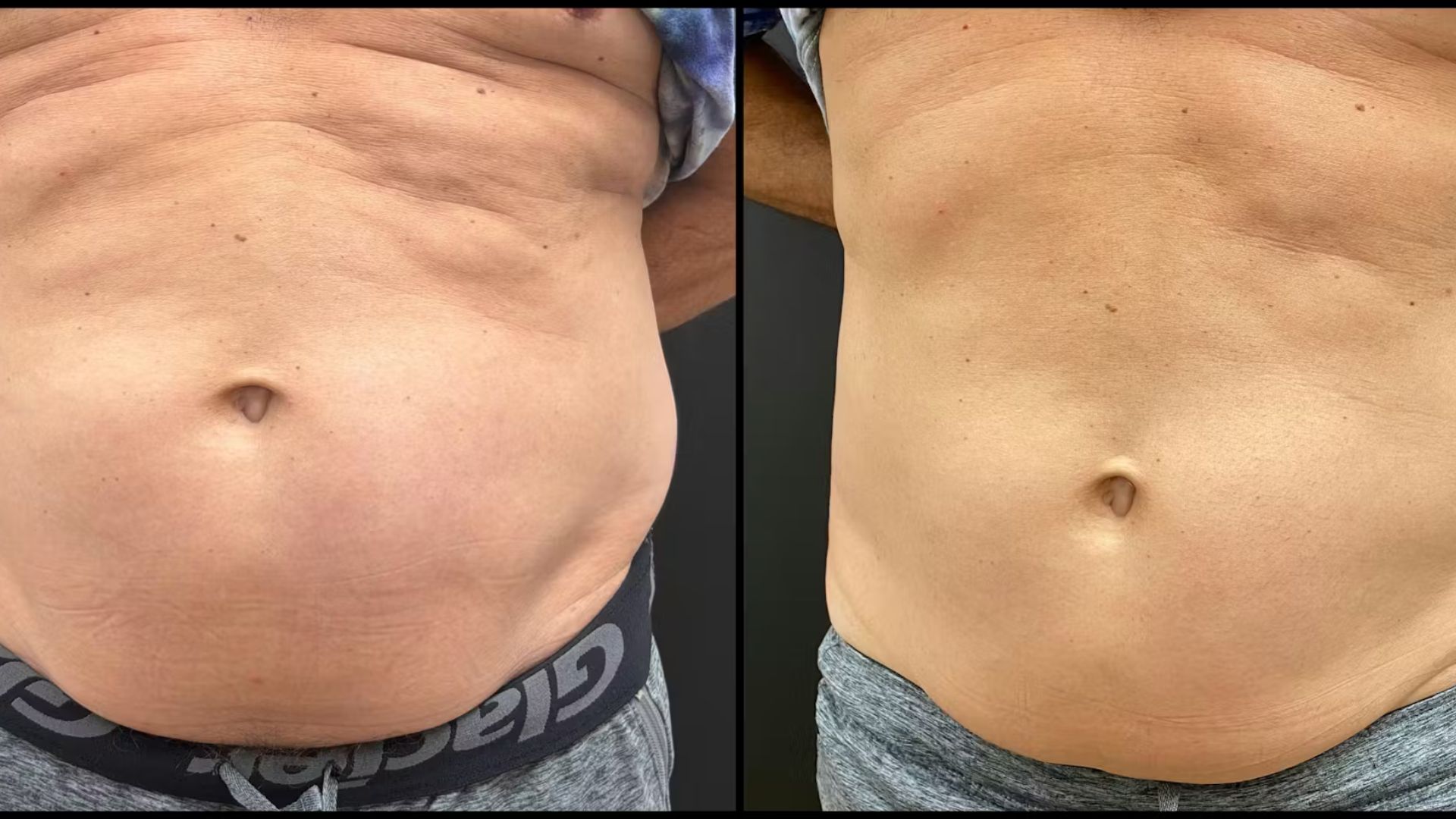 Before & After 5